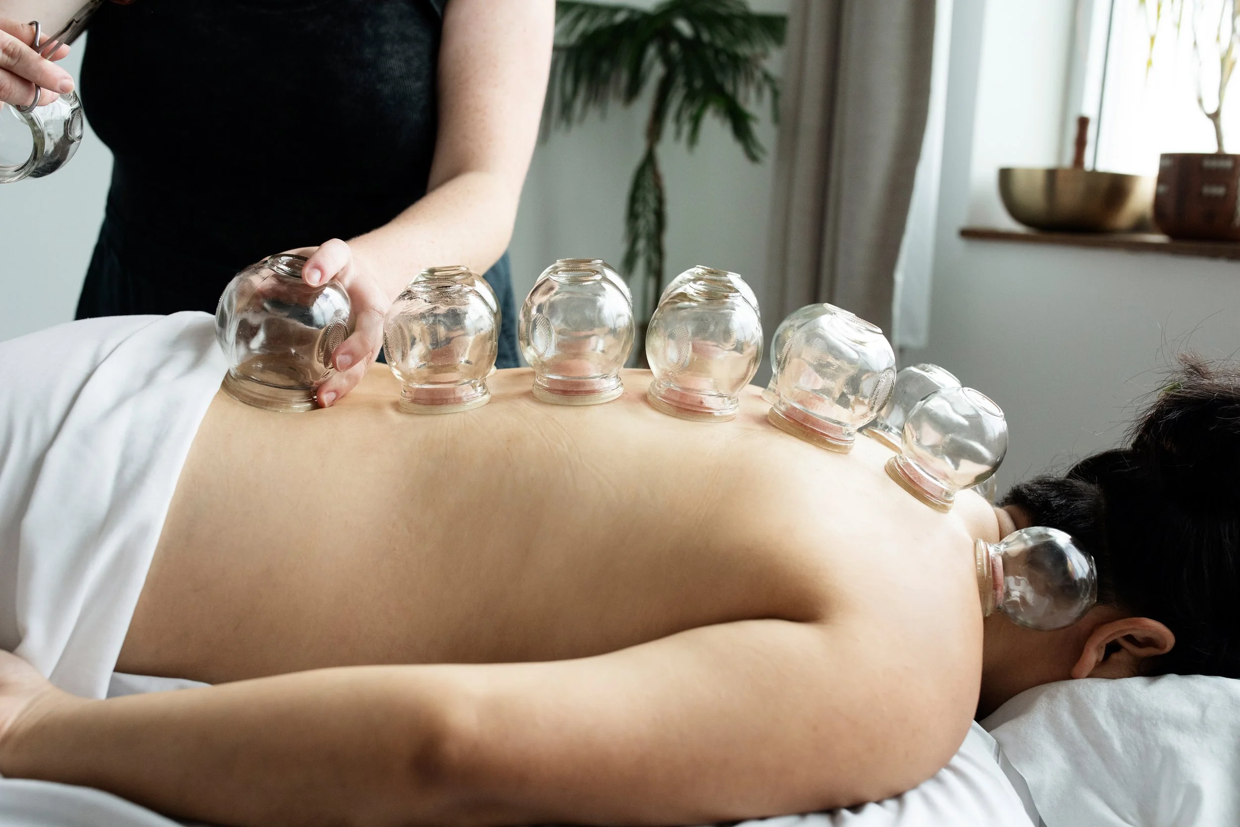 Cupping image 2